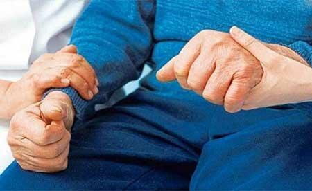 دستورالعمل جدید برای درمان پارکینسون دستورالعمل تازه برای درمان پارکینسون