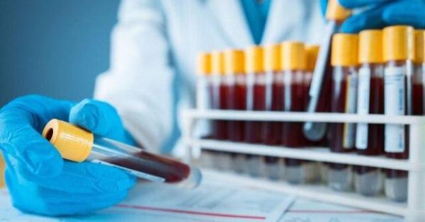 نخستین سیستم انتقال دارو و پادتن برای درمان بیماری های حاد نخستین سیستم انتقال دارو و پادتن برای درمان بیماری های حاد
